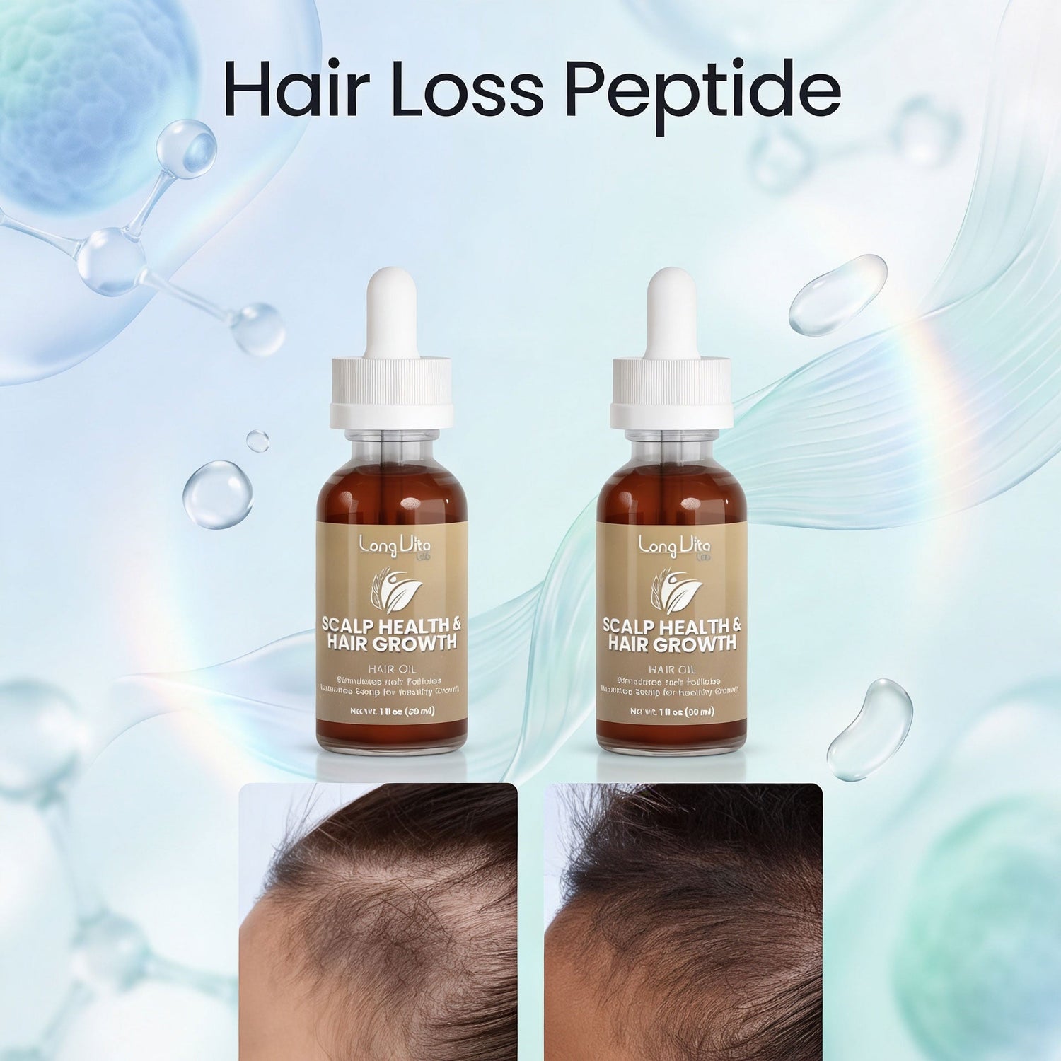 Hair Loss